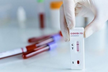 Prohíben la venta en farmacias bonaerenses de pruebas rápidas y tests para detectar Covid-19